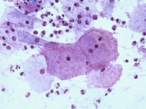 Em situações especificas, essa bactéria desenvolve alguns sintomas